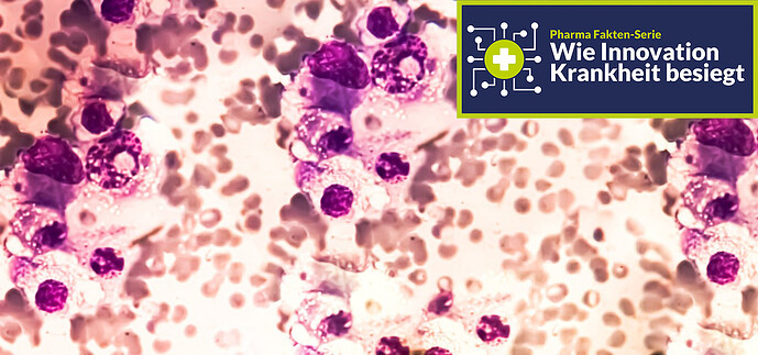 Multiples-Myelom_Slider