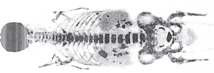 tep-scan-octobre-2025