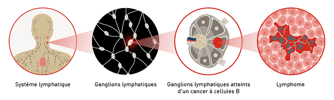 lymphome_cellules_manteau