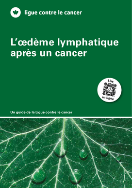 csm_l-oedeme-lymphatique-apres-un-cancer-021410013111_902480c4be